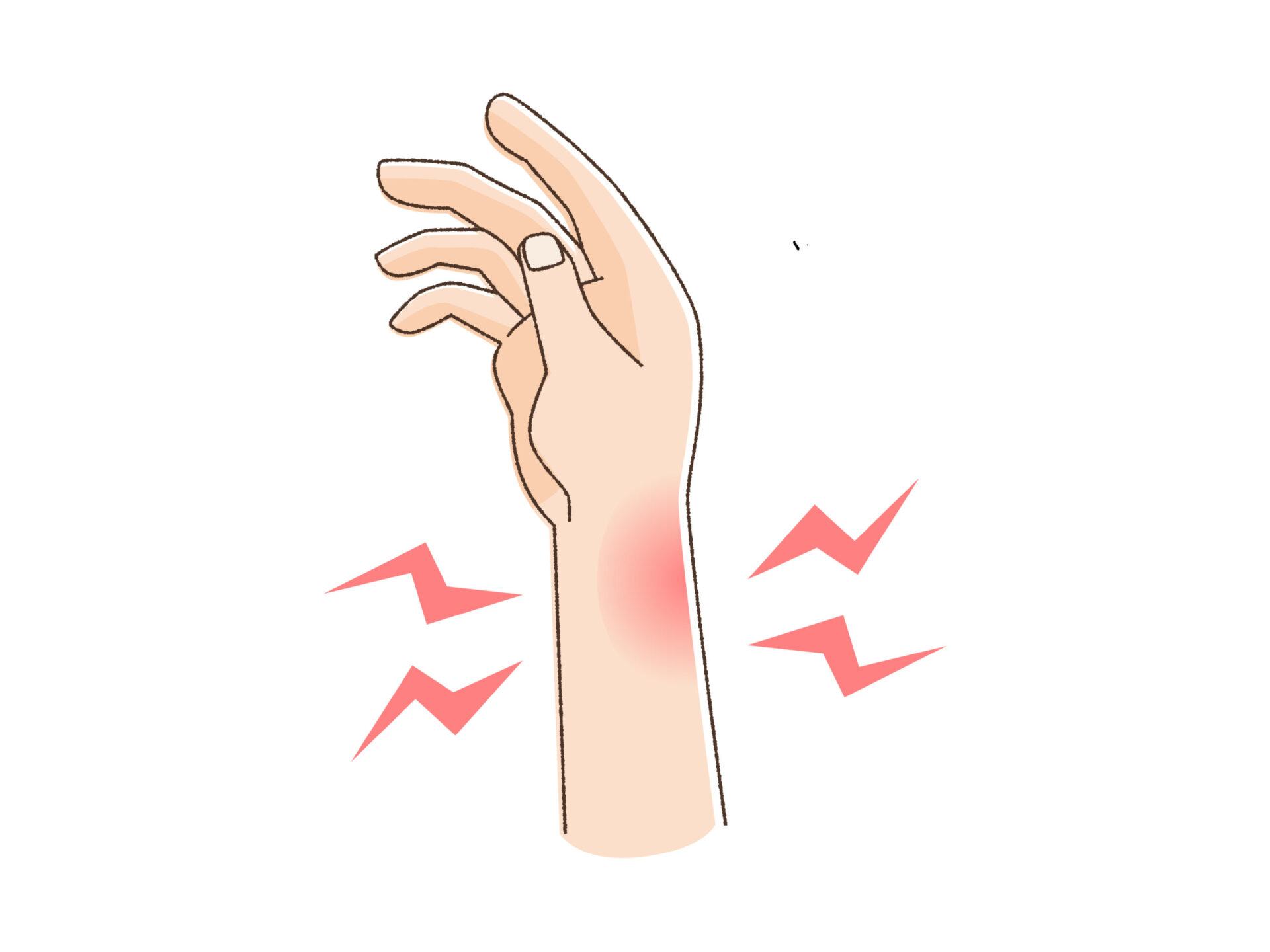 手首が痛い人のイラスト