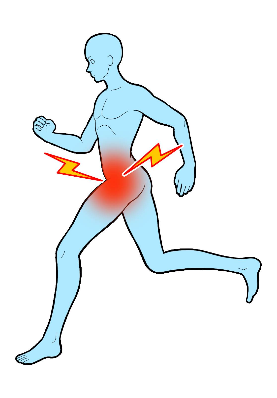 股関節が痛い人のイラスト