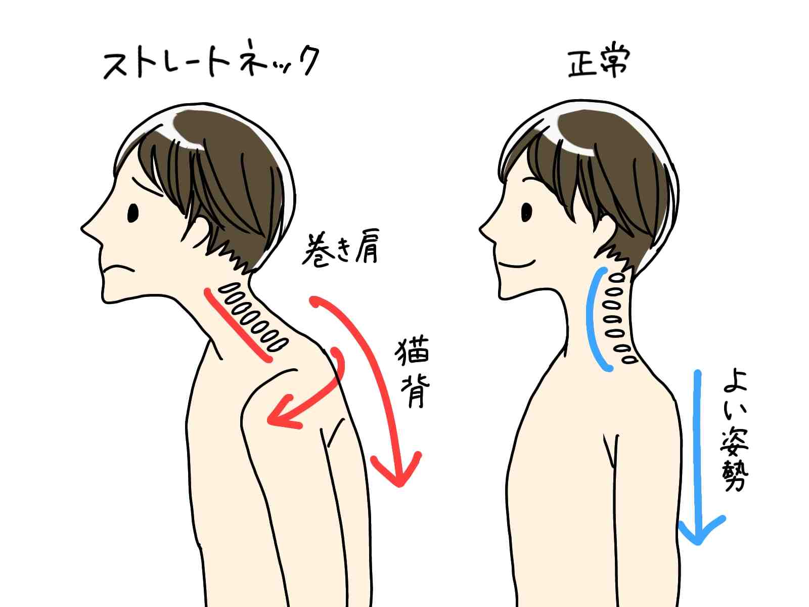 ストレートネックの男性のイラスト