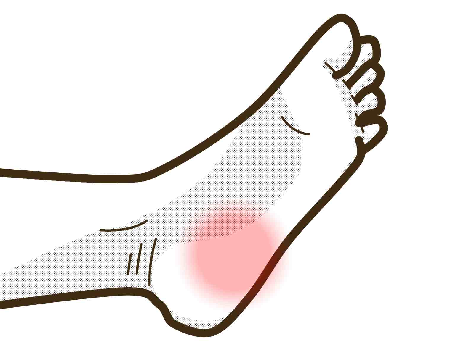 踵の痛みのイラスト