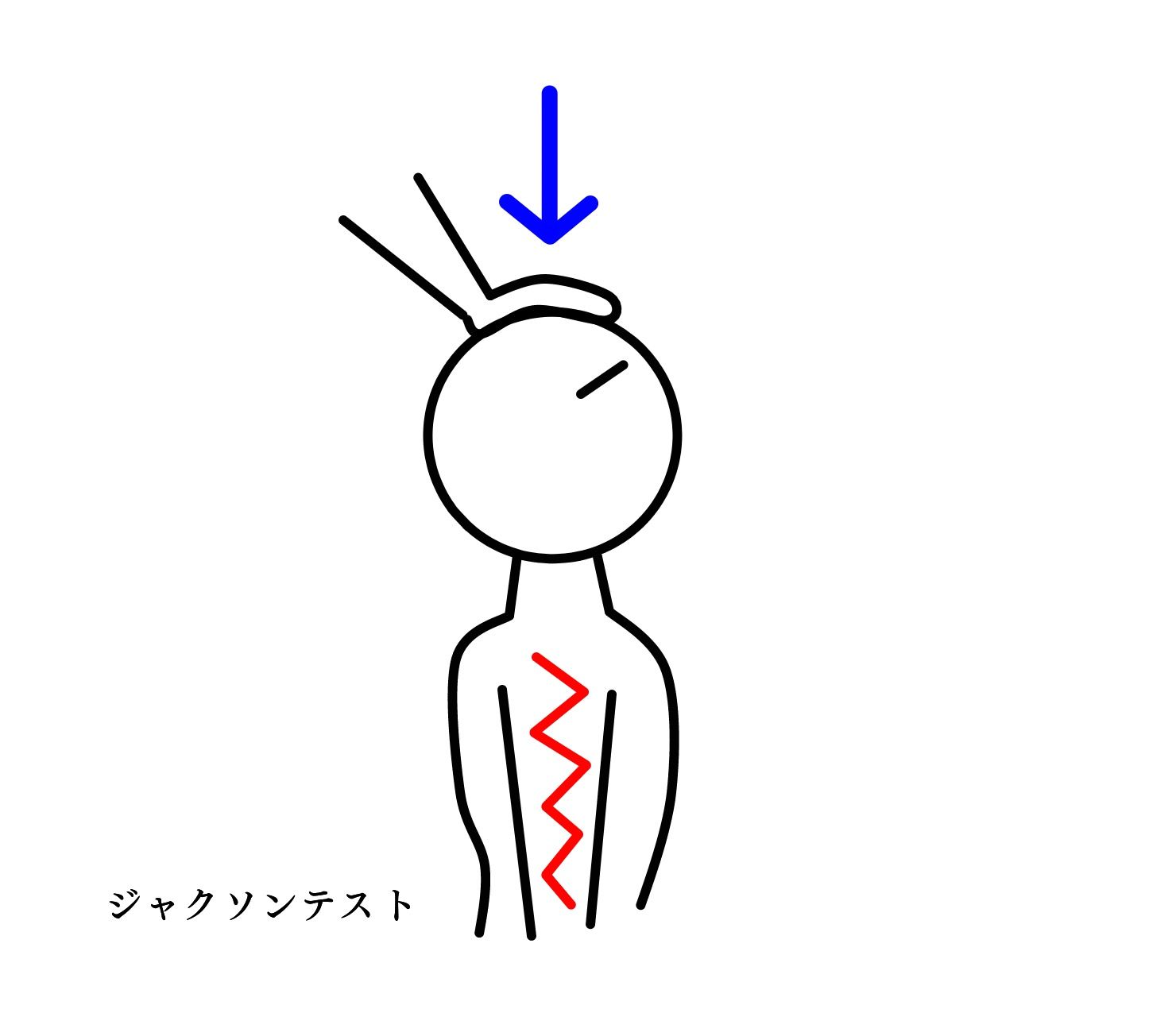 ジャクソンテストのイラスト