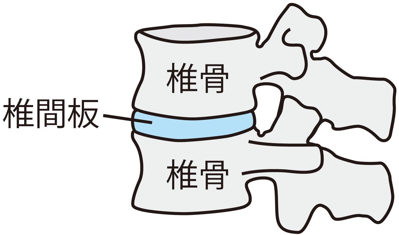 椎骨と椎間板のイラスト